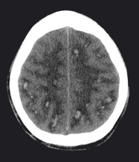 Matt Parker's Brain X-Ray